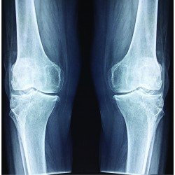 Knees