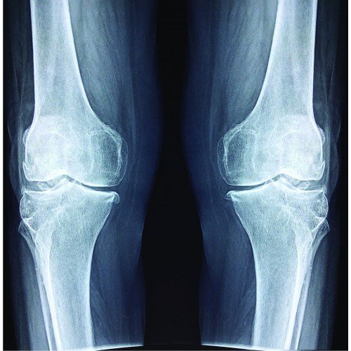 Knees